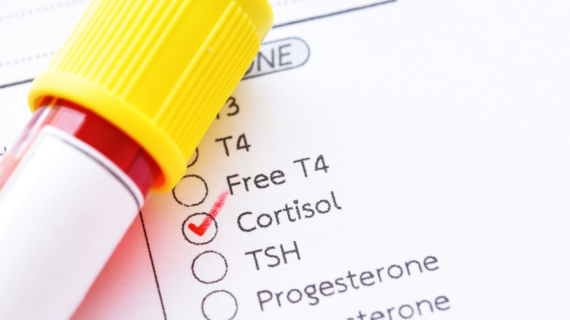 test tube laying on top of order for lab work to check for postpartum hormone imbalance