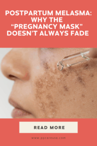 postpartum-melasma-skin
