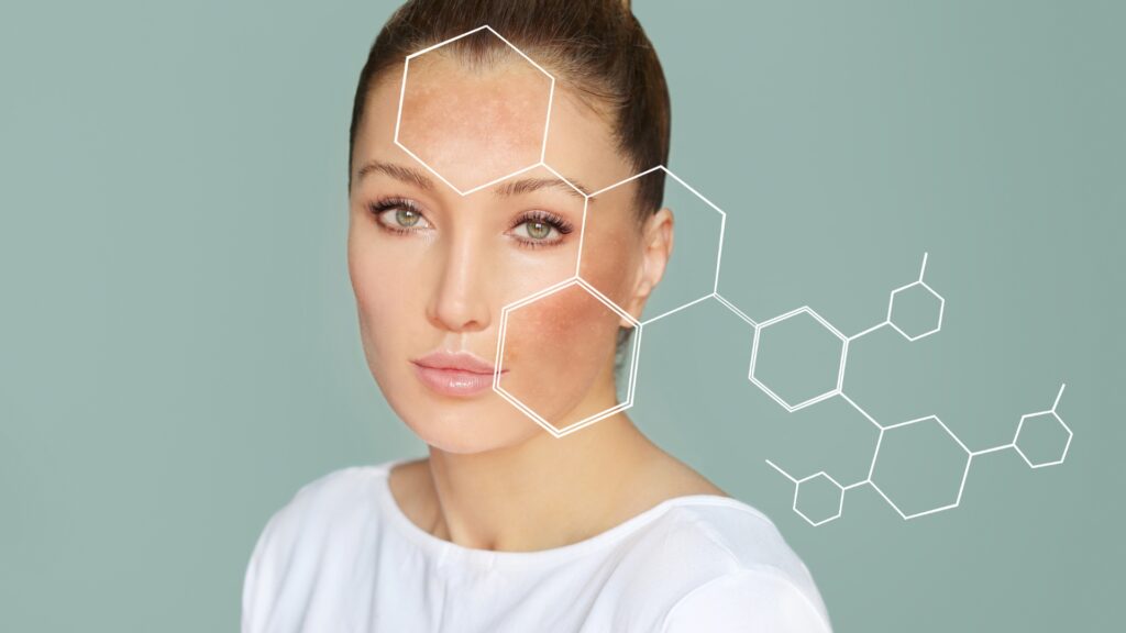 dark patches on face and skin after pregnancy